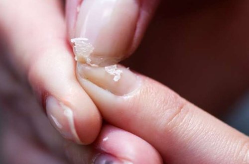 Dırnaqların qırılırsa, bu çatışmır — Nə yeməli?