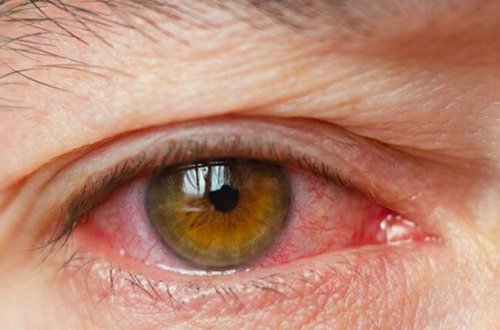 Gözlərimizi kor olmaqdan belə qoruyaq - 8 QIZIL QAYDA