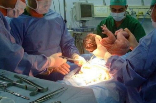 Bakıda doğuş zamanı FACİƏ: Əkiz uşaqlar öldü