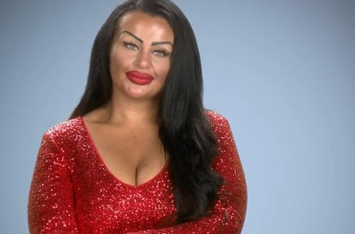 Sinə əməliyyatı uğursuz keçən qadın pis vəziyyətdə qalıb - FOTO