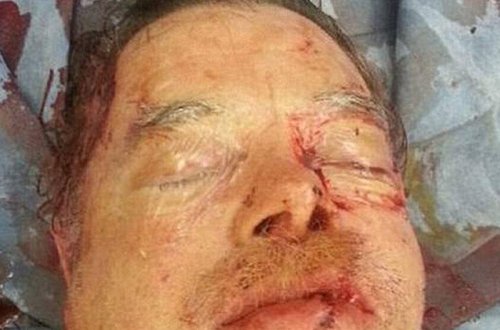 Üzünü mişarla doğradı, sonra həkim yanına yollandı - FOTO