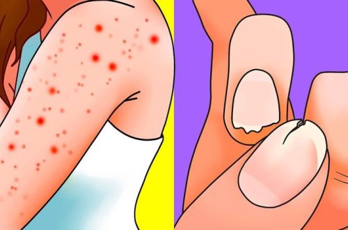 Bədənin sizdən yardım istədiyini göstərən 8 İŞARƏ