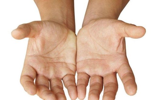 Əllərin əsməsi bu xəstəliyin ilk simptomudur - HƏKİM RƏYİ