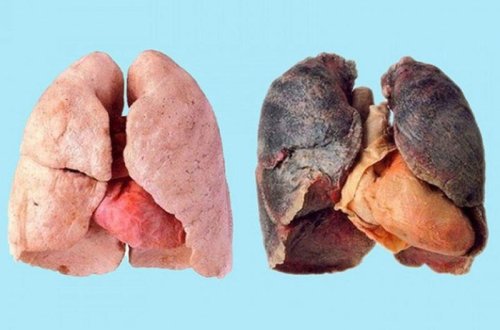 Ağciyərləri nikotindən təmizləmək üçün 9 qayda - Kişilərin diqqətinə