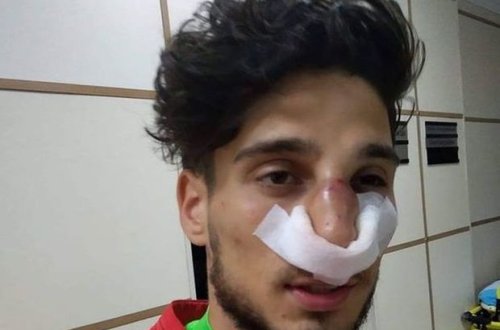 Mahir Mədətov qapıçının burnunu sındırdı - VİDEO