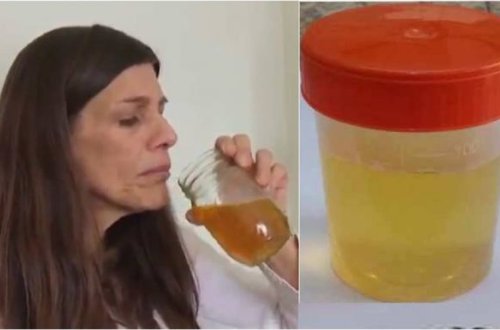 30 gün İDRARINI İÇDİ - Görün, başına nə gəldi / VİDEO