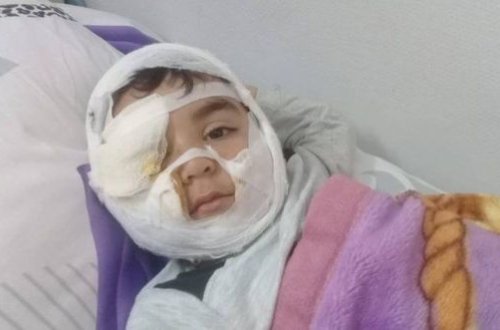 İt dişləyən 4 yaşlı uşaq palataya köçürülüb - Səhiyyə Nazirliyi