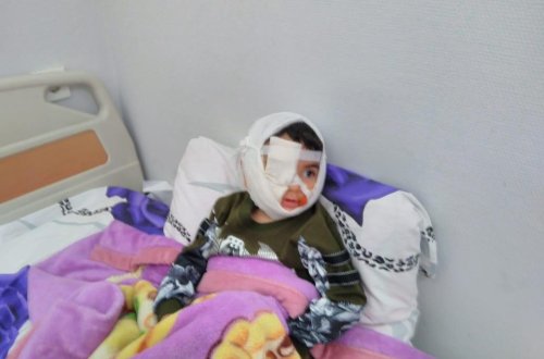 Покусанный собакой мальчик переведен в палату – минздрав Азербайджана