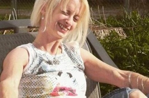 41 yaşlı qadın amansız xəstəliyə tutuldu: Hər gün qocalır - FOTOLAR