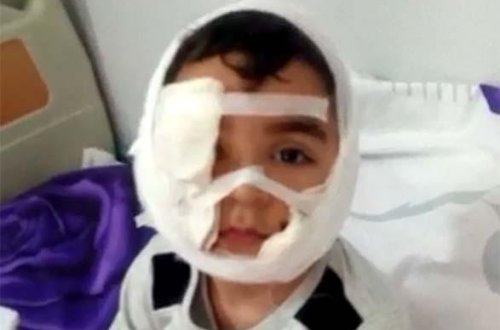 Распространены кадры с мальчиком, покусанным бешеной собакой в Баку (ВИДЕО)