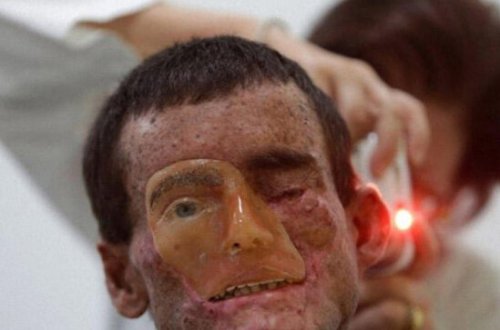 Bu qəsəbənin sakinlərini gün işığı əridir - Dəhşətli görüntülər - FOTO