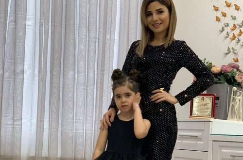 Günay qısa ətəkdə izləyicilərin diqqətini çəkdi - FOTO