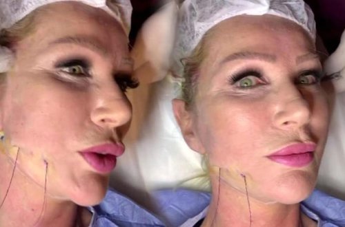 Üzünü dartdıran məşhurun QORXUNC GÖRÜNTÜLƏRİ – FOTO