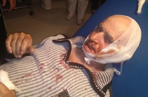 Lənkəranda bir gecədə 9 nəfəri it dişləyib - FOTO