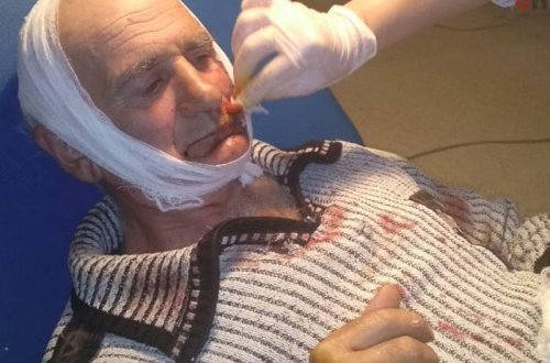 Azərbaycanda quduz itin 9 nəfəri dişlədiyi həmin DƏHŞƏTLİ ANLAR - VİDEO