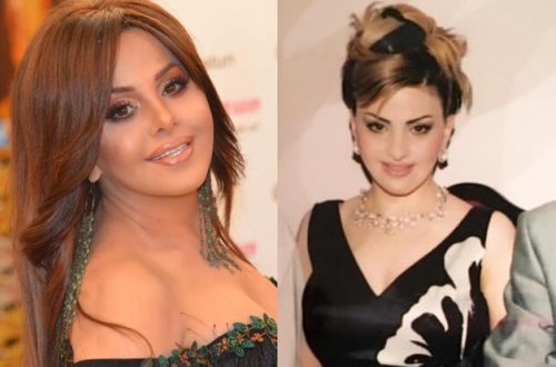 Mətanət plastik əməliyyatsız fotosunu paylaşdı: 