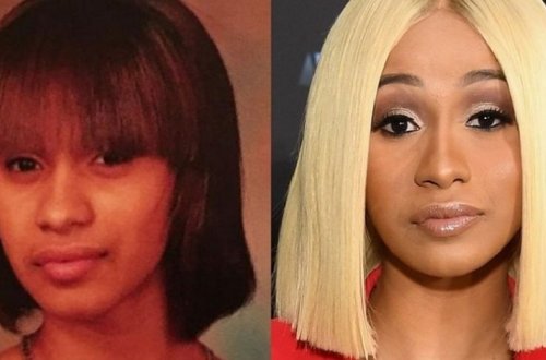 Карди Би до и после пластики - ФОТО