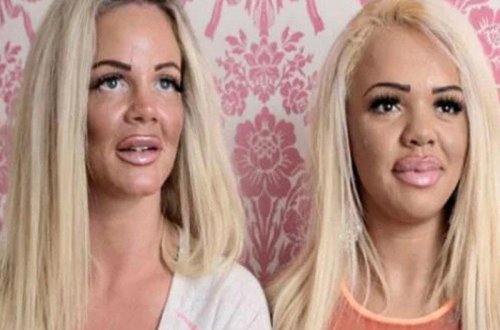 Plastik əməliyyat üçün qızını fahişəliyə məcbur edən ananın FOTOLARI