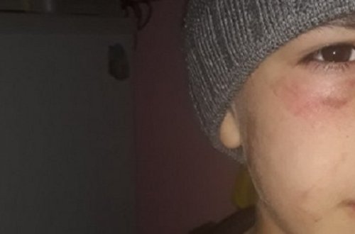 В Баку полицейские нашли на улице ребенка, зверски избитого матерью – ФОТО