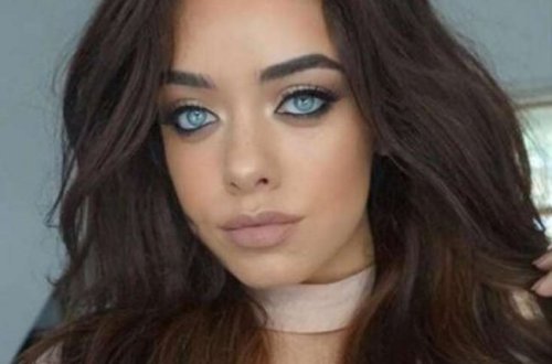 Cəzbedici gözəl estetik əməliyyatla görün nə günə düşdü? /FOTO