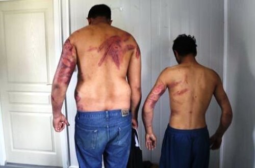 Bu foto görənləri dəhşətə gətirdi: Yarıçılpaq kişiləri vəhşicəsinə döydülər, zorla...