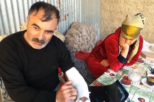 Azərbaycanda DƏHŞƏTLİ OLAY! Həkim xəstənin xəbəri olmadan qolunu kəsdi - VİDEO