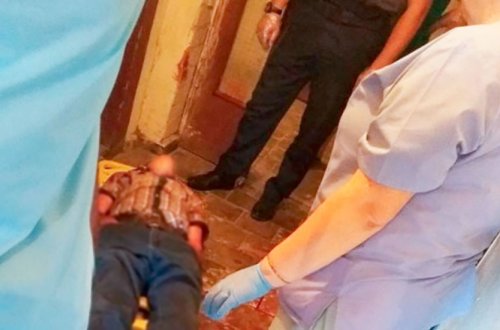 Azərbaycanda “nadzor” başından güllələnərək öldürüldü