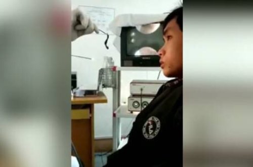 Burun ağrısı şikayəti ilə həkimə getdi, içindən çıxanlar şok yaratdı