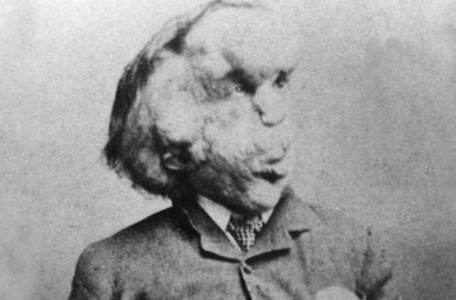 В Лондоне обнаружили затерянную могилу Человека-слона