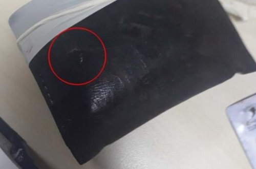 Cibindəki pul kisəsi baxın nəyə səbəb oldu? - fotolar