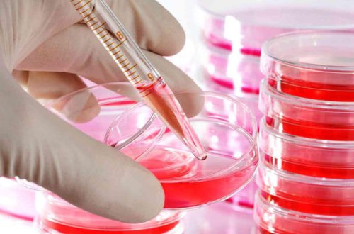 В Азербайджане инвалидность получили 70 больных талассемией