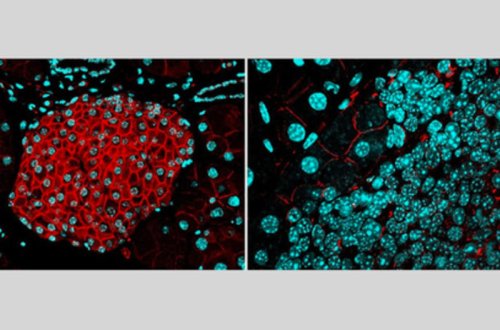 Найден способ предотвратить смерть от рака