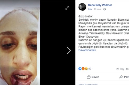 Azərbaycanda ər arvadını döyüb bu hala saldı - ŞOK FOTO