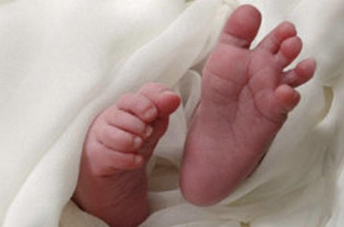 Ребенок родился с мозгом на лице - ФОТО