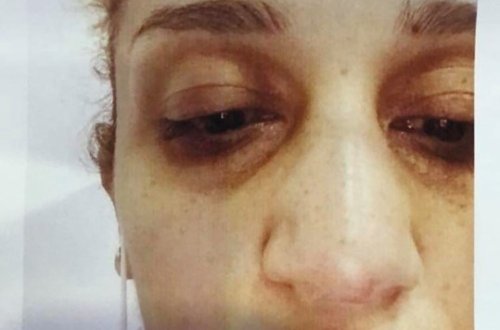 SON DƏQİQƏ: Bakıda anaya lesbi adı qoyub uşaqlarından ayırdılar - FOTOLAR