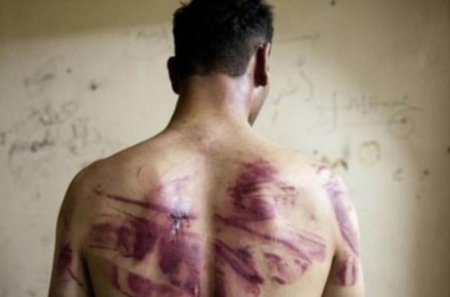 Tükürpədən cinayətlər - diri-diri yandırıldı, zorlandı və...