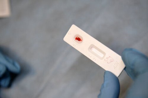 Dəhşətli cinsi xəstəliyin tüğyan etdiyi bölgələr - ŞOK XƏBƏRDARLIQ