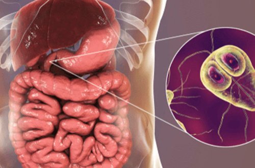 Lyambliyoz nədir, necə yoluxur? – QORXULU VİRUSUN ƏLAMƏTLƏRİ