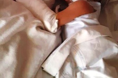 Bakıda üzərinə benzin tökülən 2 yaşlı Anjelanın SON HALI - FOTO