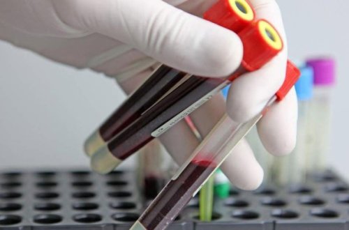 Məşhur alim xərçəngin yaranma SƏBƏBİNİ AÇDI