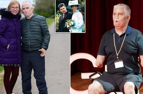 Diş həkiminə gedəndən sonra əl və ayaqlarından məhrum olub