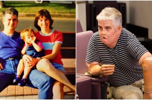 3 ay komada qaldıqdan sonra ayıldı, qolları, əlləri və üzünün kəsildiyini gördü - şok