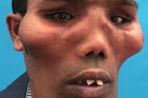 Aslan sifət oğlan dəyişib bu hala düşdü, heç kim tanımadı - FOTO