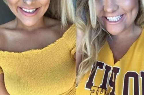 Artıq çəkisindən xilas olan qadın bu hala DÜŞDÜ - FOTOLAR