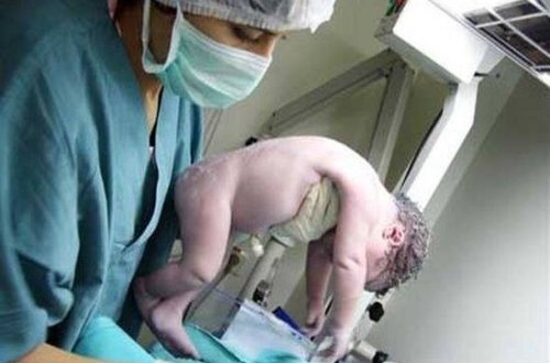 Azərbaycanda ŞOK OLAY! Həkimlər anaya yeni doğulan körpəsini ölü kimi TƏQDİM EDİB... - foto