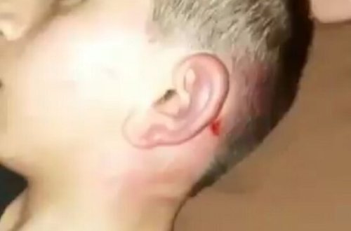 Azərbaycanda ata oğlunu VƏHŞİCƏSİNƏ DÖYDÜ - VİDEO