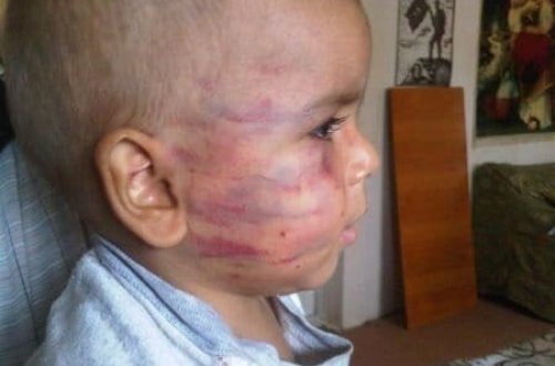 Bakıda ögey ata azyaşlı körpəni VƏHŞİCƏSİNƏ DÖYDÜ - FOTO