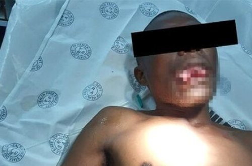 Qadın həkim ona təcavüz edən xəstənin dilini qopardı: DİŞİ İLƏ... (+18 FOTO)