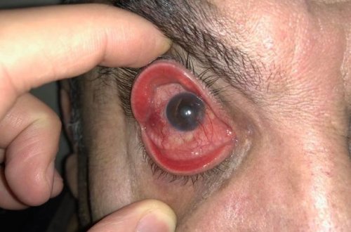 Gədəbəy sakininin gözünə bıçaq soxdular