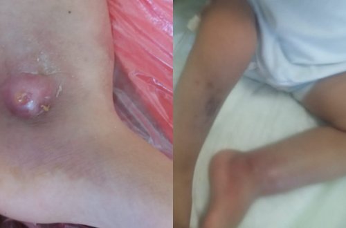 “Medi Lux”də körpəni qorxulu virusa yoluxdurdular – Mehriban Əliyevaya müraciət - FOTO